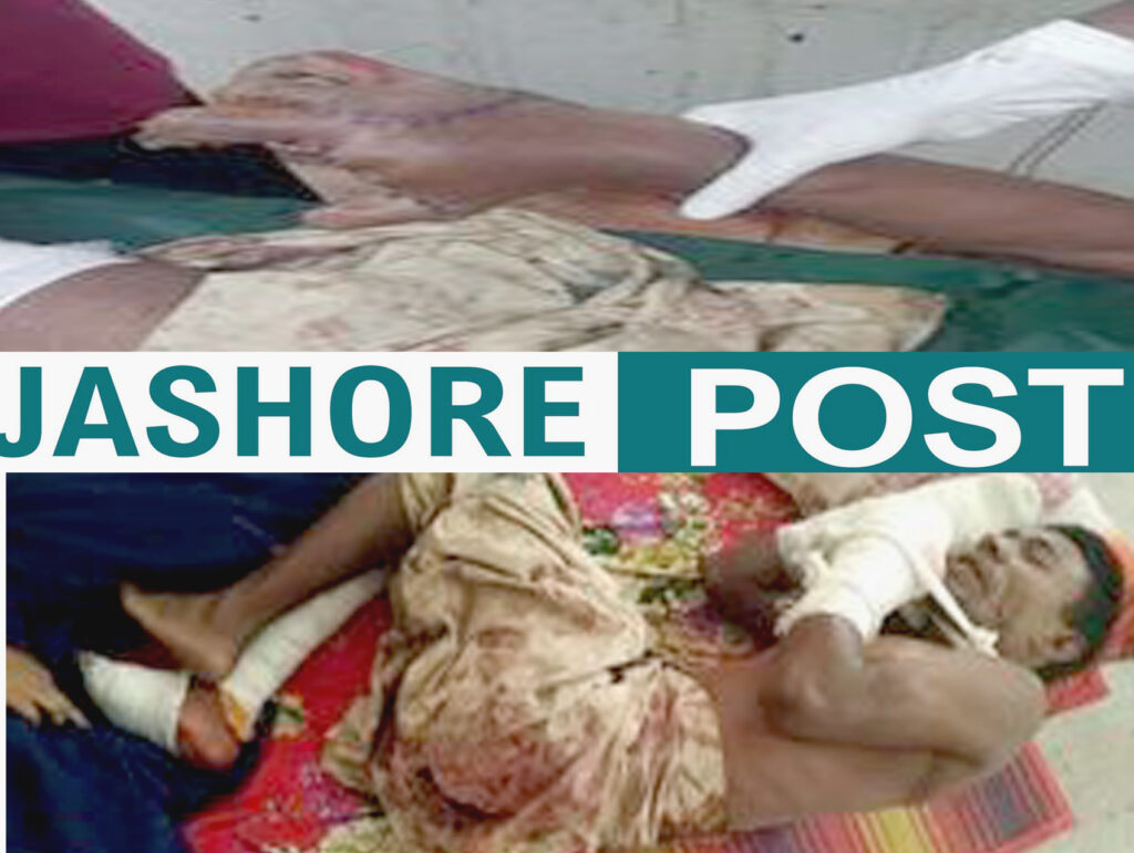 ঝিকরগাছায় বোমা তৈরীকালে বিষ্ফোরণে সন্ত্রাসী বিল্লাল আহত