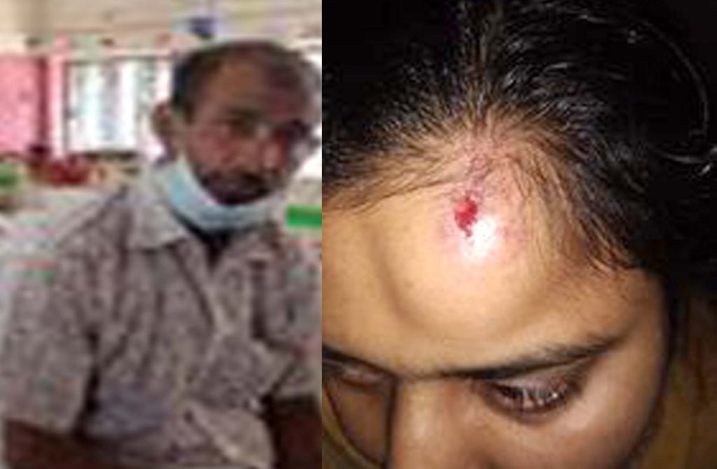 বড় ভাইয়ের মেয়েকে পিটিয়ে জখম করলো আপন চাচা
