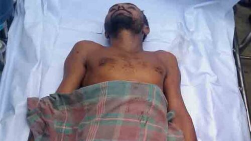 শার্শায় বজ্রপাতে বন্দর শ্রমিকের মৃত্যু