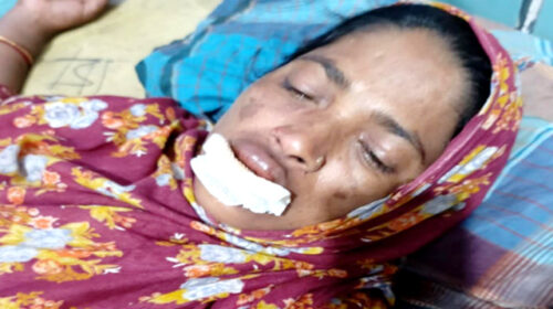 নন্দীগ্রামে জমিজমা সংক্রান্তে প্রতিপক্ষের হামলায় নারী আহত