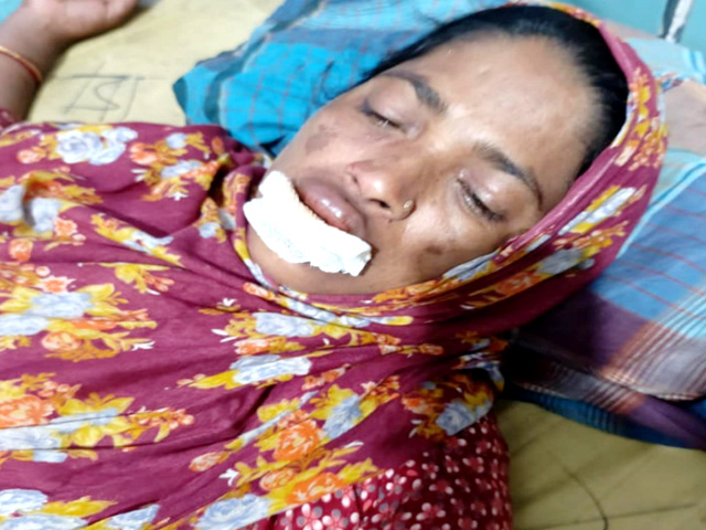 নন্দীগ্রামে জমিজমা সংক্রান্তে প্রতিপক্ষের হামলায় নারী আহত